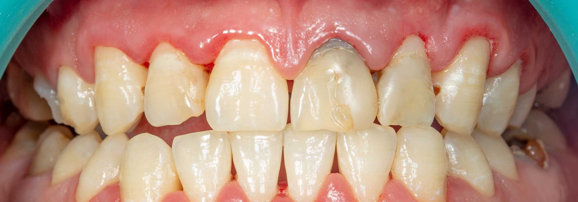 Nav's Dental - Dr. Víctor M. Navarro Sousa - Dentista Colonia